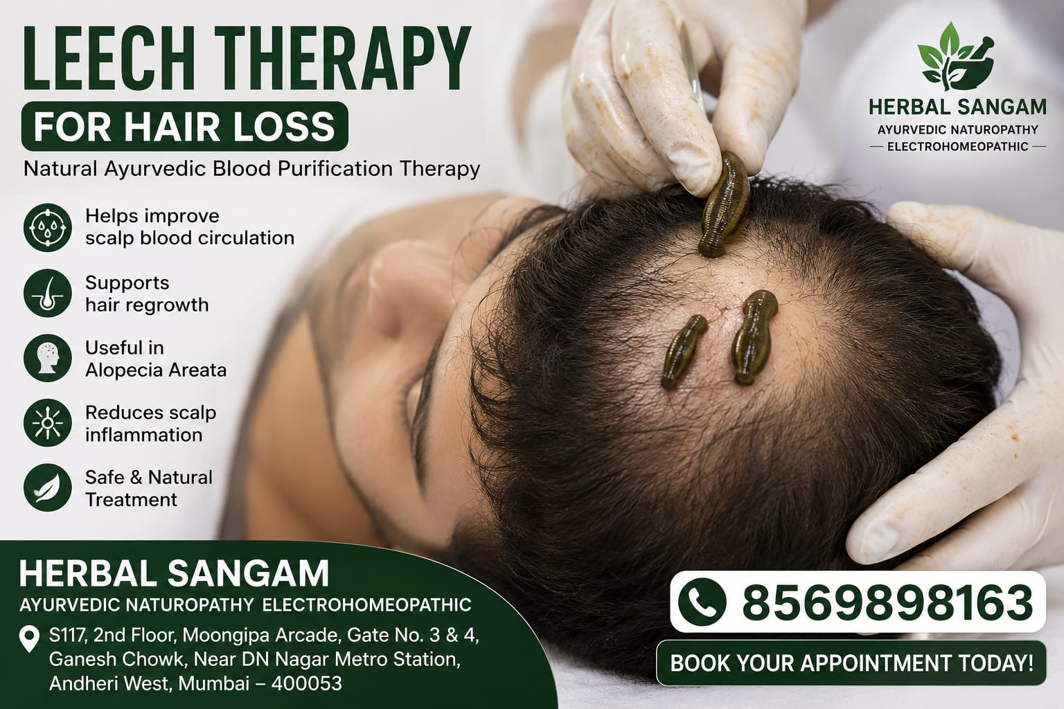 Leech Therapy for Acne and Pimples with Nasya